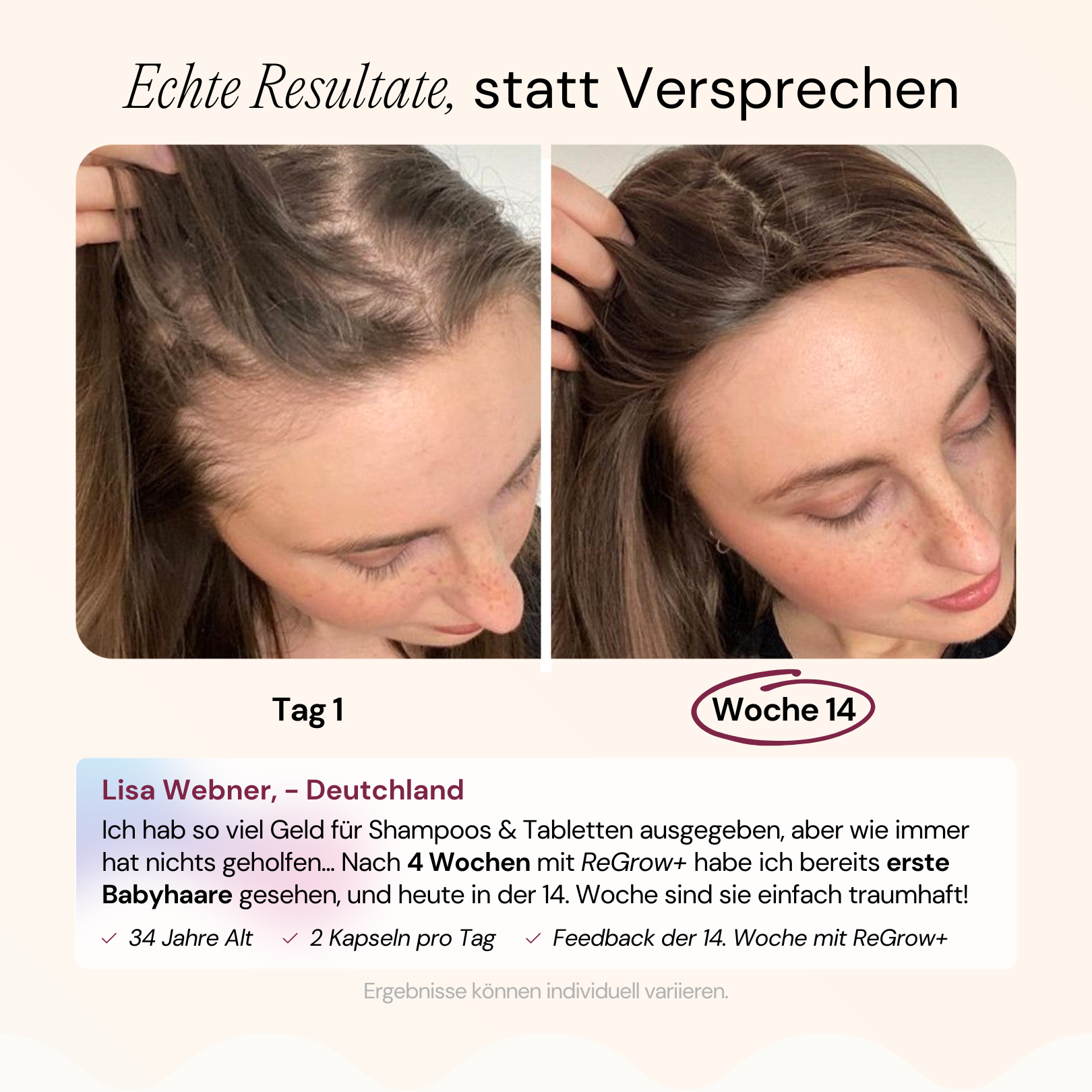 ReGrow+ Haarvitamin