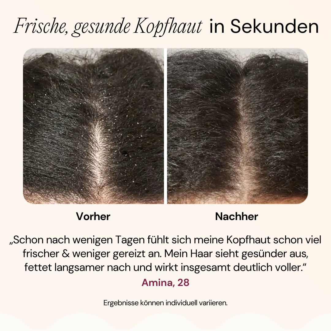 Vélar - Scalp Detox