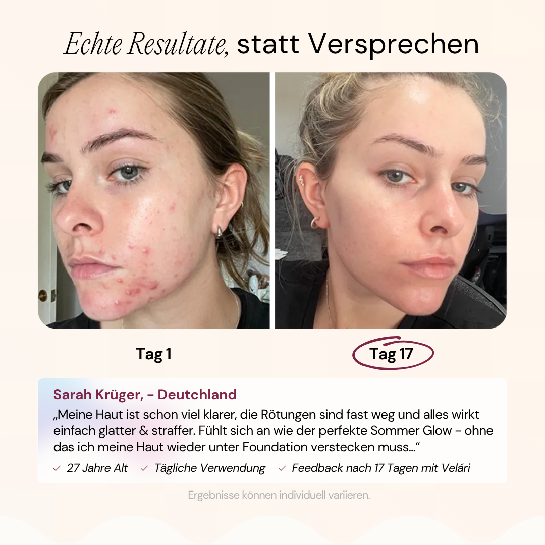 Velári - Med. Hautpflaster